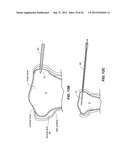 NAVIGATION AND POSITIONING SYSTEMS AND GUIDE INSTRUMENTS FOR JOINT REPAIR diagram and image