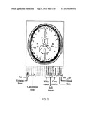 NEUROCRANIAL ELECTROSTIMULATION MODELS, SYSTEMS, DEVICES AND METHODS diagram and image