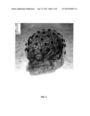 NEUROCRANIAL ELECTROSTIMULATION MODELS, SYSTEMS, DEVICES AND METHODS diagram and image