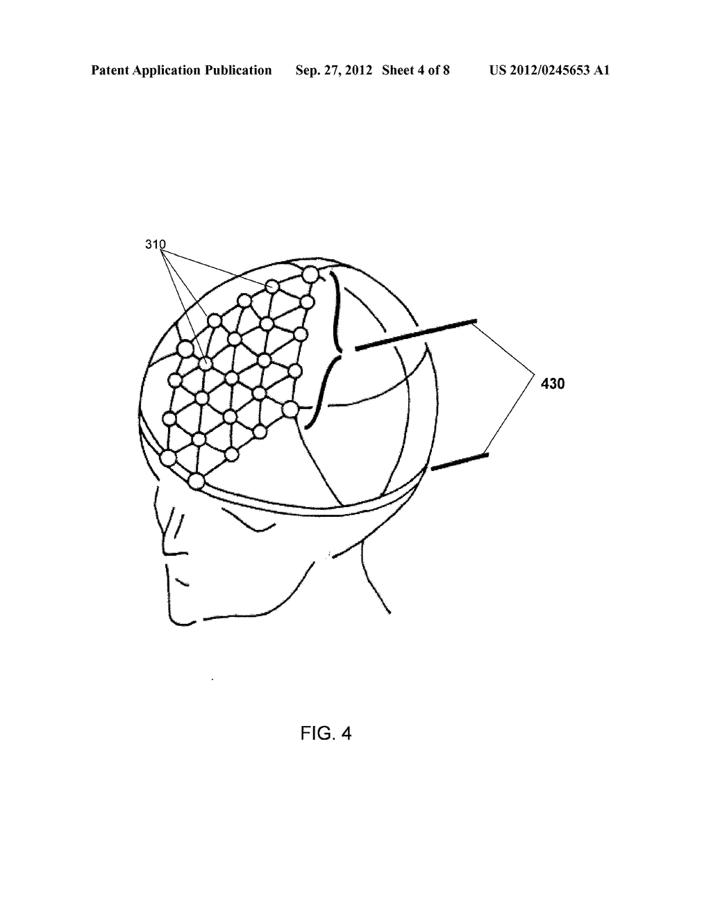 NEUROCRANIAL ELECTROSTIMULATION MODELS, SYSTEMS, DEVICES AND METHODS - diagram, schematic, and image 05