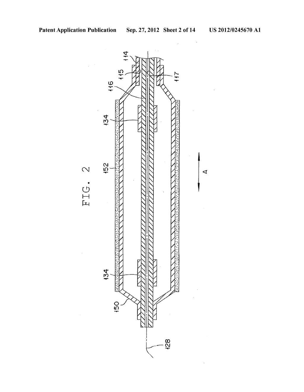 STENT DELIVERY SYSTEM AND METHOD USING THE SAME - diagram, schematic, and image 03