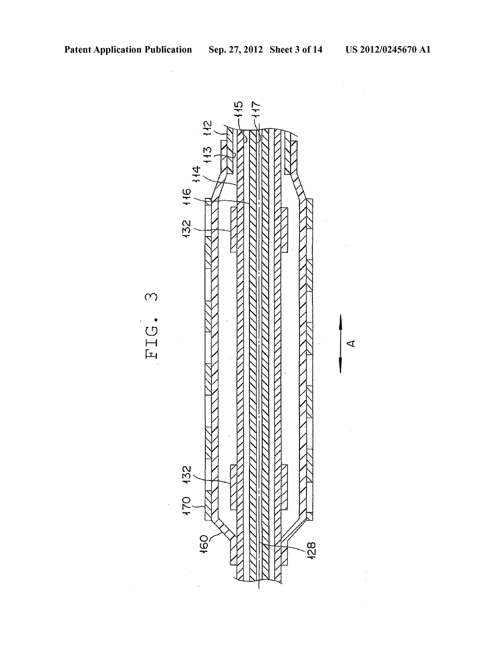 STENT DELIVERY SYSTEM AND METHOD USING THE SAME - diagram, schematic, and image 04