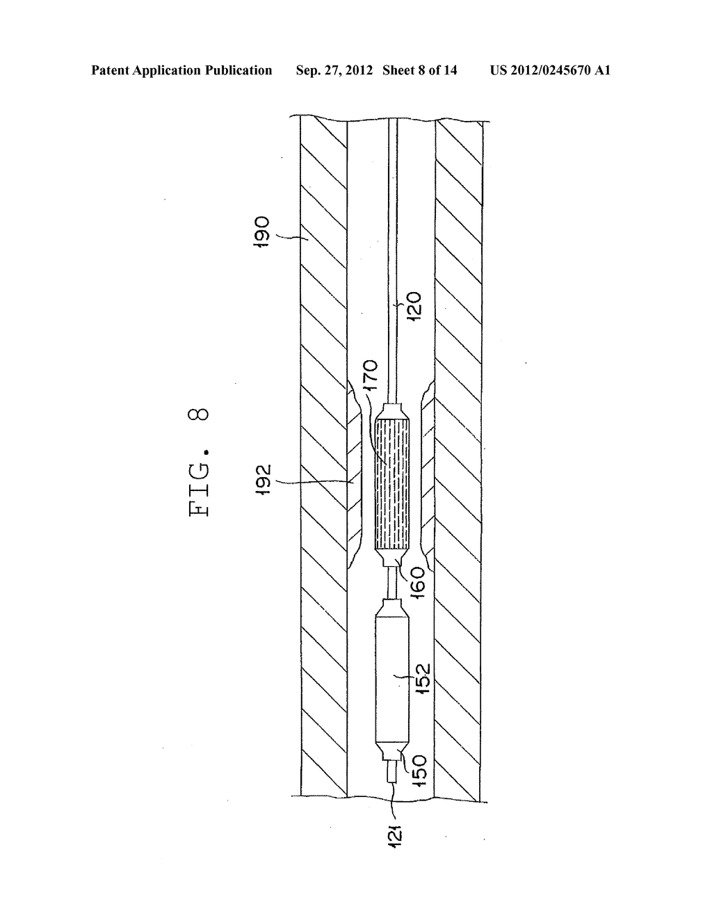 STENT DELIVERY SYSTEM AND METHOD USING THE SAME - diagram, schematic, and image 09