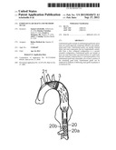 Endovascular Grafts and Methods of Use diagram and image