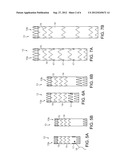 Endovascular Grafts and Methods of Use diagram and image