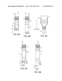 Endovascular Grafts and Methods of Use diagram and image