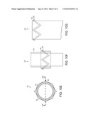 Endovascular Grafts and Methods of Use diagram and image