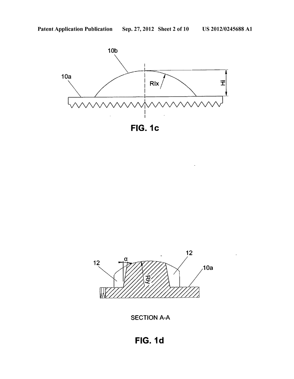 Universal disc prosthesis - diagram, schematic, and image 03