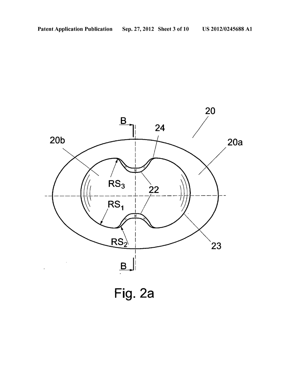 Universal disc prosthesis - diagram, schematic, and image 04