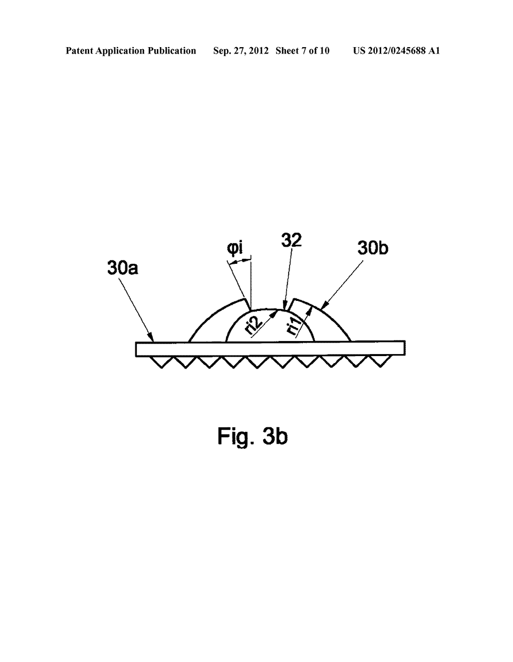 Universal disc prosthesis - diagram, schematic, and image 08