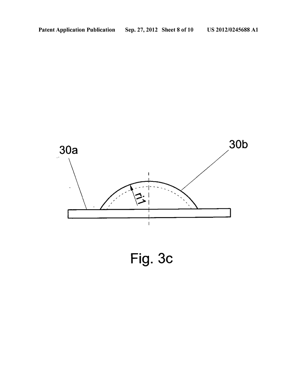 Universal disc prosthesis - diagram, schematic, and image 09