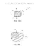 ENDPLATE-PRESERVING SPINAL IMPLANT WITH AN INTEGRATION PLATE HAVING     DURABLE CONNECTORS diagram and image