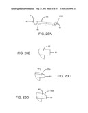 ENDPLATE-PRESERVING SPINAL IMPLANT WITH AN INTEGRATION PLATE HAVING     DURABLE CONNECTORS diagram and image