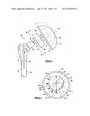 SHOULDER PROSTHESIS diagram and image