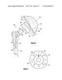 SHOULDER PROSTHESIS diagram and image