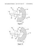 SHOULDER PROSTHESIS diagram and image