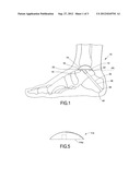 Hemi Ankle Implant diagram and image