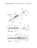 SLEEVE FOR BONE FIXATION DEVICE diagram and image