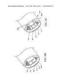 SLEEVE FOR BONE FIXATION DEVICE diagram and image