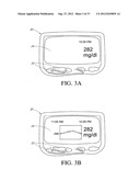 SYSTEMS AND METHODS FOR REPLACING SIGNAL ARTIFACTS IN A GLUCOSE SENSOR     DATA STREAM diagram and image