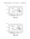 SYSTEMS AND METHODS FOR REPLACING SIGNAL ARTIFACTS IN A GLUCOSE SENSOR     DATA STREAM diagram and image