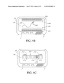 SYSTEMS AND METHODS FOR REPLACING SIGNAL ARTIFACTS IN A GLUCOSE SENSOR     DATA STREAM diagram and image