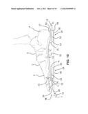 SHOE SOLE WITH ENERGY RESTORING DEVICE diagram and image