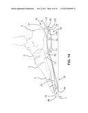 SHOE SOLE WITH ENERGY RESTORING DEVICE diagram and image