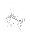 Adjustable head restraint system diagram and image