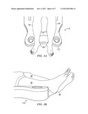 Heel Support For Multiple Patient Orientations diagram and image