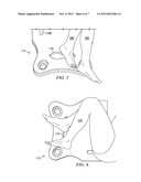 Heel Support For Multiple Patient Orientations diagram and image