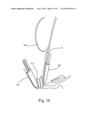 Method of Manufacturing Flexible Shell Inlay Strips diagram and image