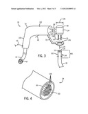 INDUCTION HEATING WIRE INSULATION HEATING AND REMOVAL diagram and image