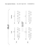 METHOD AND APPARATUS FOR REDUCTION OF SPECIFIC ABSORPTION RATE (SAR) IN     MAGNETIC RESONANCE DATA ACQUISITION diagram and image