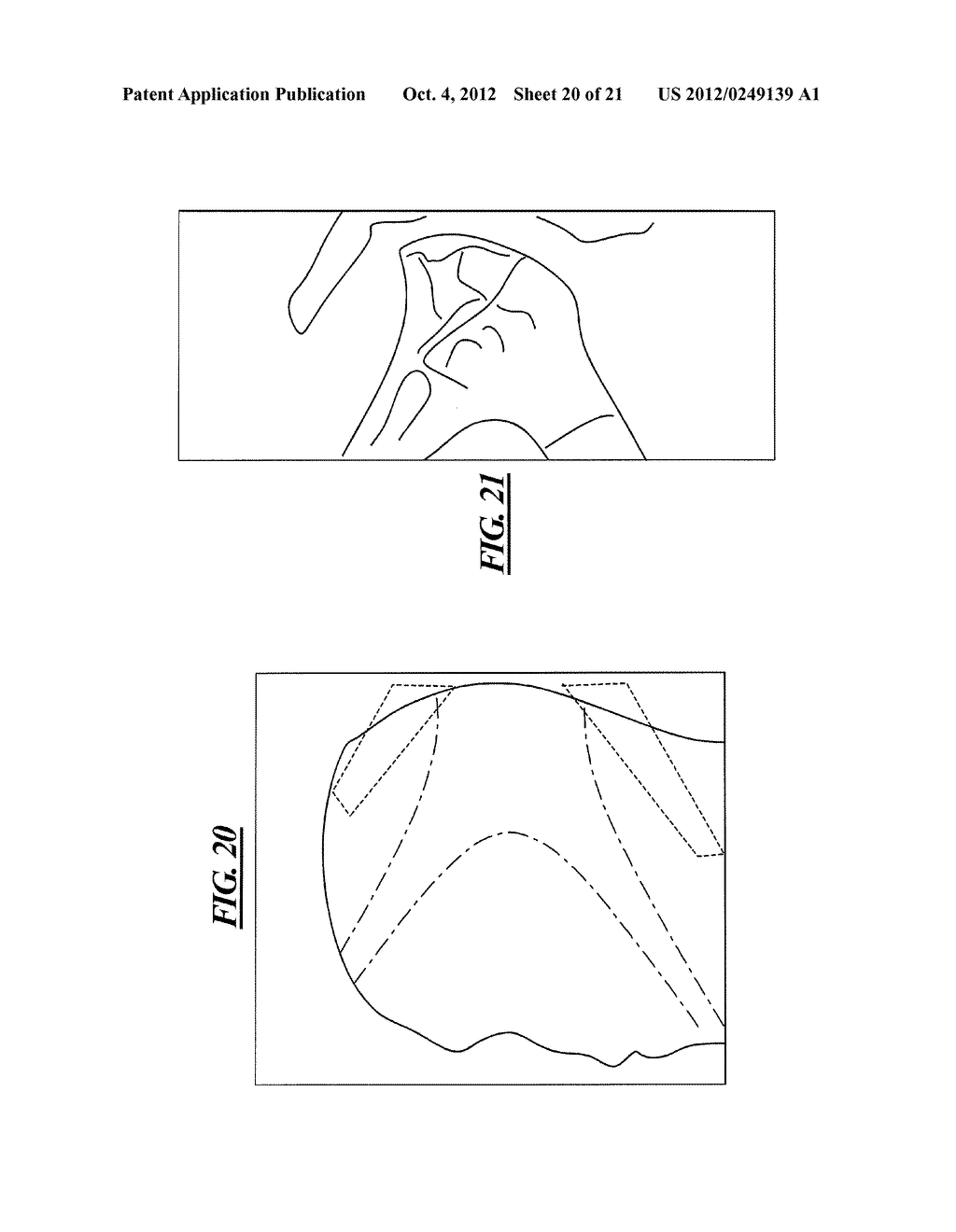 METHOD AND APPARATUS FOR REDUCTION OF SPECIFIC ABSORPTION RATE (SAR) IN     MAGNETIC RESONANCE DATA ACQUISITION - diagram, schematic, and image 21