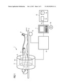 METHOD FOR CORRECTING A DISTORTION IN A MAGNETIC RESONANCE RECORDING diagram and image