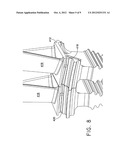 Turbine Blade Platform Undercut diagram and image