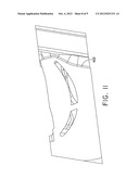 Turbine Blade Platform Undercut diagram and image