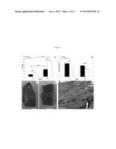 Infarction Treatment Compositions and Methods diagram and image