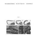 Infarction Treatment Compositions and Methods diagram and image