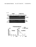 METHOD FOR DIAGNOSIS/PROGNOSIS OF CANCERS USING AN EPIGENETIC MARKER     CONSISTING OF A SPECIFIC SINGLE CPG SITE IN TTP PROMOTER AND TREATMENT OF     CANCERS BY REGULATING ITS EPIGENETIC STATUS diagram and image