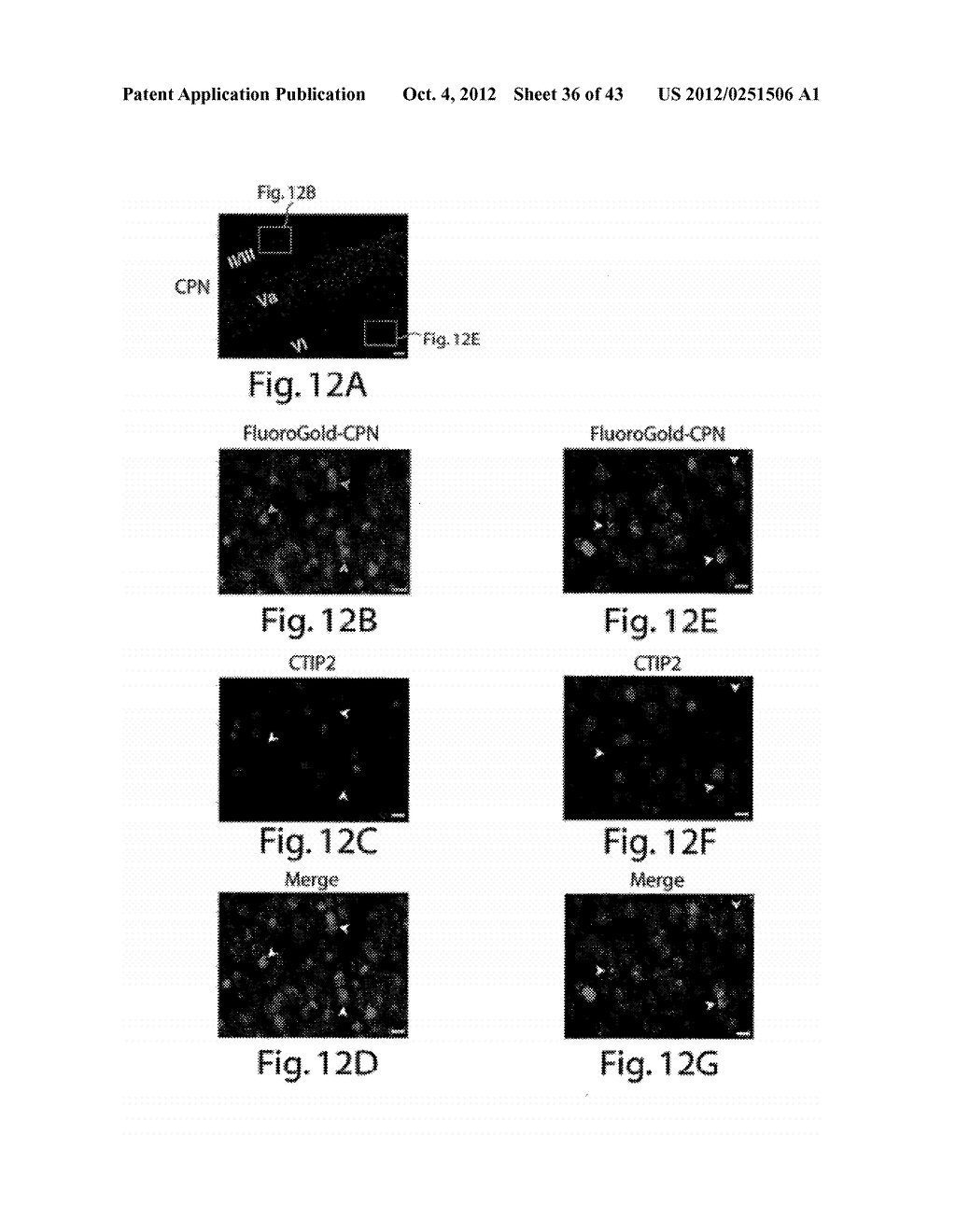 METHODS AND COMPOSITIONS RELATING TO NEURONAL CELL AND TISSUE     DIFFERENTIATION - diagram, schematic, and image 37