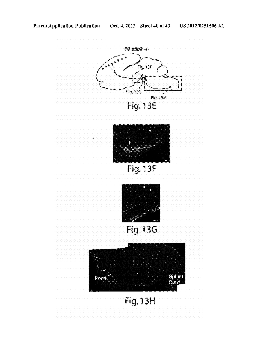 METHODS AND COMPOSITIONS RELATING TO NEURONAL CELL AND TISSUE     DIFFERENTIATION - diagram, schematic, and image 41