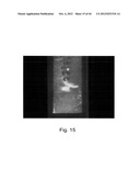 AGENTS FOR PROMOTING TISSUE REGENERATION BY RECRUITING BONE MARROW     MESENCHYMAL STEM CELLS AND/OR PLURIPOTENT STEM CELLS INTO BLOOD diagram and image