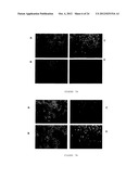 PHARMACEUTICAL COMPOSITION FOR TREATING CANCER  COMPRISING TRYPSINOGEN     AND/OR CHYMOTRYPSINOGEN AND AN ACTIVE AGENT SELECTED FROM A SELENIUM     COMPOUND, A VANILLOID COMPOUND AND A CYTOPLASMIC GLYCOLYSIS REDUCTION     AGENT diagram and image