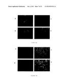 PHARMACEUTICAL COMPOSITION FOR TREATING CANCER  COMPRISING TRYPSINOGEN     AND/OR CHYMOTRYPSINOGEN AND AN ACTIVE AGENT SELECTED FROM A SELENIUM     COMPOUND, A VANILLOID COMPOUND AND A CYTOPLASMIC GLYCOLYSIS REDUCTION     AGENT diagram and image