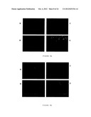 PHARMACEUTICAL COMPOSITION FOR TREATING CANCER  COMPRISING TRYPSINOGEN     AND/OR CHYMOTRYPSINOGEN AND AN ACTIVE AGENT SELECTED FROM A SELENIUM     COMPOUND, A VANILLOID COMPOUND AND A CYTOPLASMIC GLYCOLYSIS REDUCTION     AGENT diagram and image