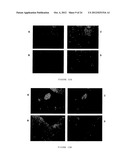 PHARMACEUTICAL COMPOSITION FOR TREATING CANCER  COMPRISING TRYPSINOGEN     AND/OR CHYMOTRYPSINOGEN AND AN ACTIVE AGENT SELECTED FROM A SELENIUM     COMPOUND, A VANILLOID COMPOUND AND A CYTOPLASMIC GLYCOLYSIS REDUCTION     AGENT diagram and image