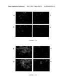 PHARMACEUTICAL COMPOSITION FOR TREATING CANCER  COMPRISING TRYPSINOGEN     AND/OR CHYMOTRYPSINOGEN AND AN ACTIVE AGENT SELECTED FROM A SELENIUM     COMPOUND, A VANILLOID COMPOUND AND A CYTOPLASMIC GLYCOLYSIS REDUCTION     AGENT diagram and image