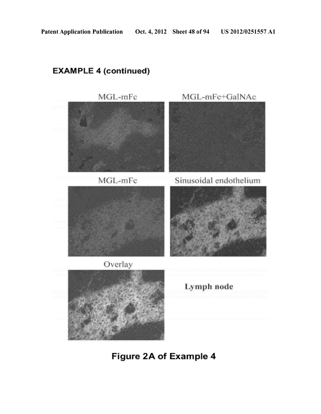 GalNAc-SPECIFIC BINDING MOLECULES AND USES THEREOF - diagram, schematic, and image 49